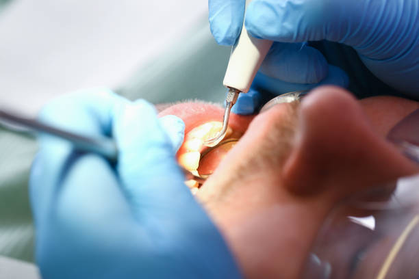 Best Urgent Dental Care for Toothache in Eufaula, OK